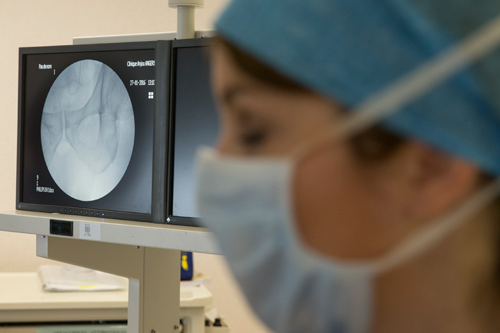 CANCER DU TESTICULE