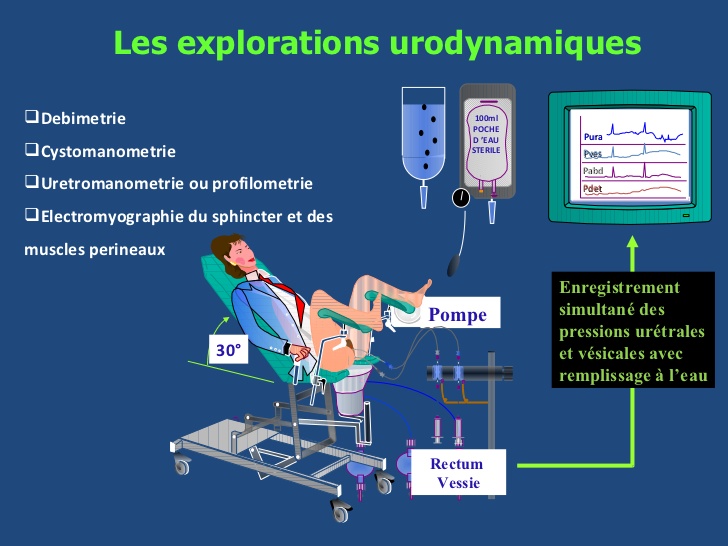 explorations urodynamiques